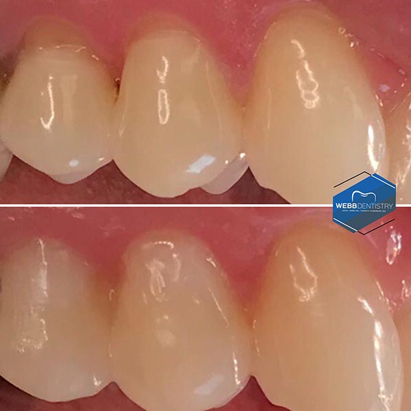 b Dentistry Before & After Photos
