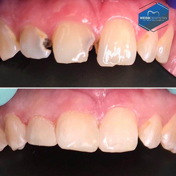 b Dentistry Before & After Photos